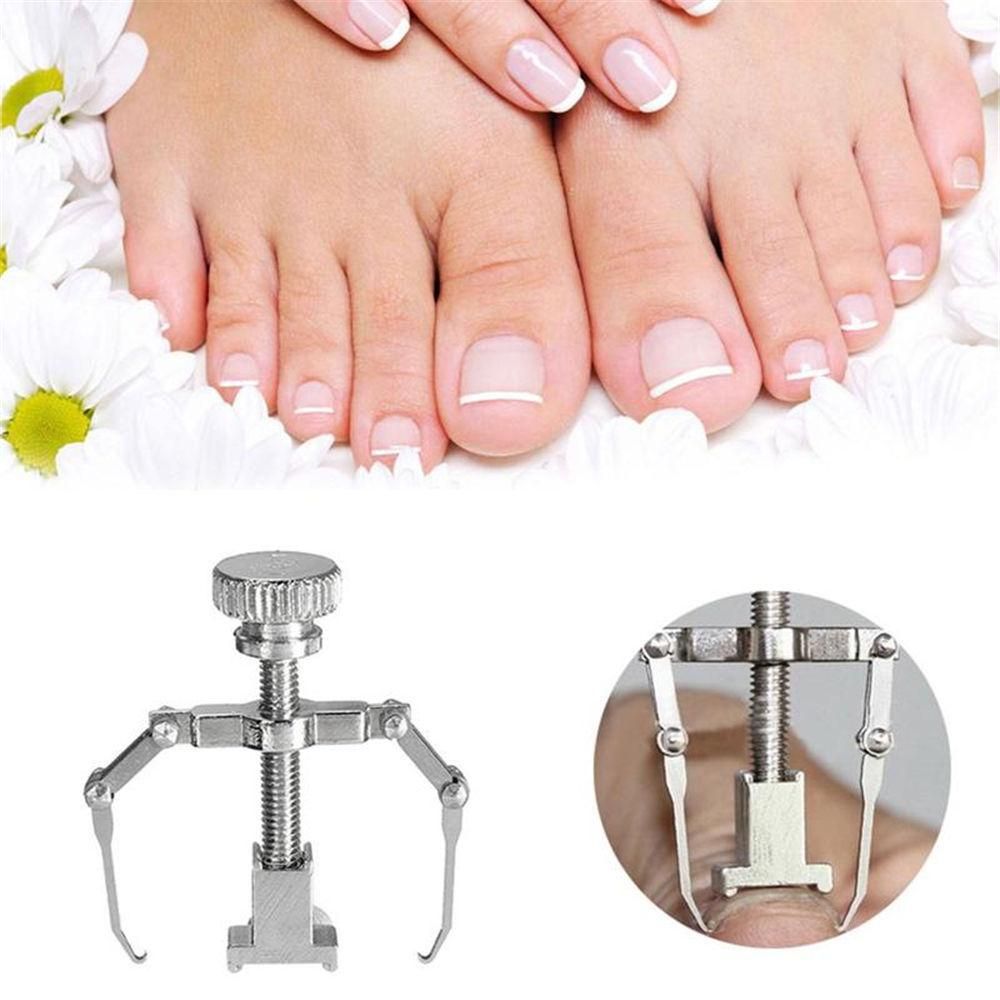 Ingrown Toenails Correction Pedicure Foot Toe Nail Care Straightening Clip Tools
