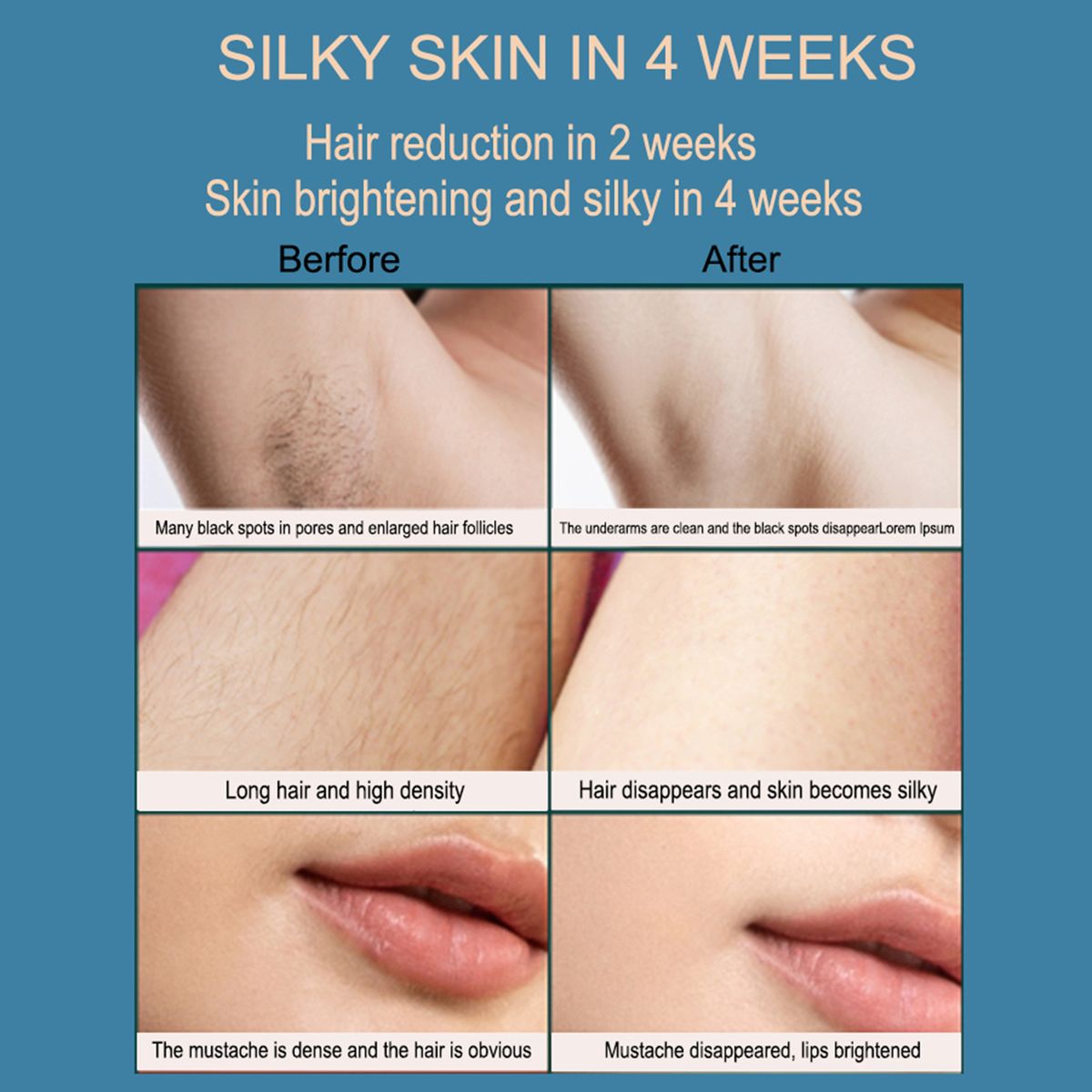 IPL Hair Removal Instrument Shaving Tool Epilator
