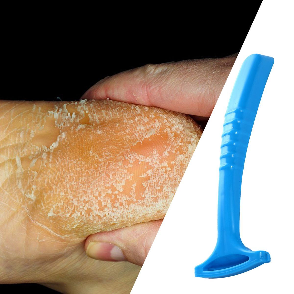 Foot File Comfortable To Grip Convenient ABS Dead Skin-Blue