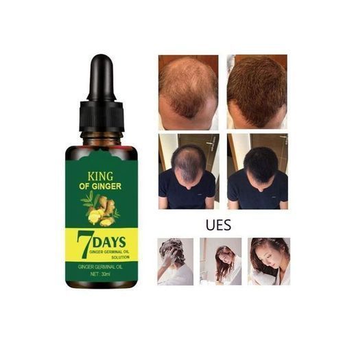 King Of Ginger (7Days Ginger Germination Hair Growth Oil 30ML)