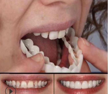 Perfect Smile Teeth Fake Tooth Cover False Teeth Veneers