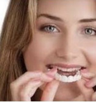 Perfect Smile Teeth Fake Tooth Cover False Teeth Veneers