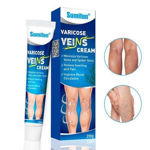 Varicose Veins Cream Removal Treatments
