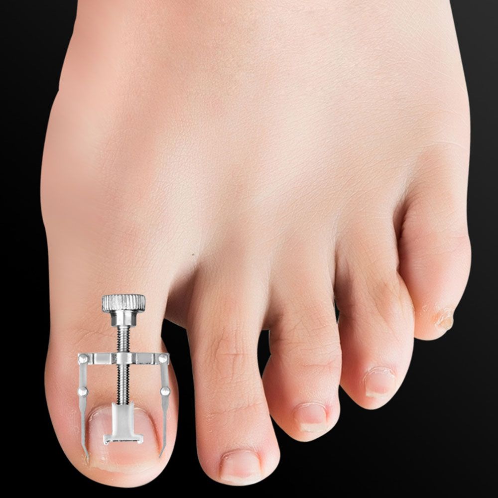 7PCS Ingrown Toenail Tools Kit Nail Treatment Pedicure Tools