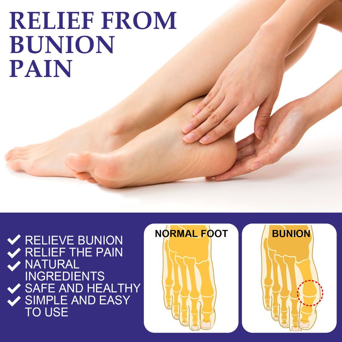 5Pcs Anti Bunion Patch Relieve Pain Prevent Bunion