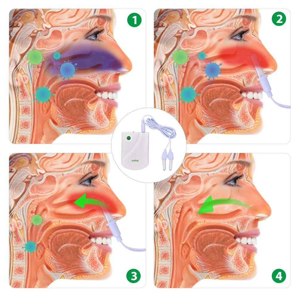 Nose Treatment Rhinitis Therapy Device Sinusitis Relief Nose Cure Device Cure Nasal Allergic Laser Light Health Care
