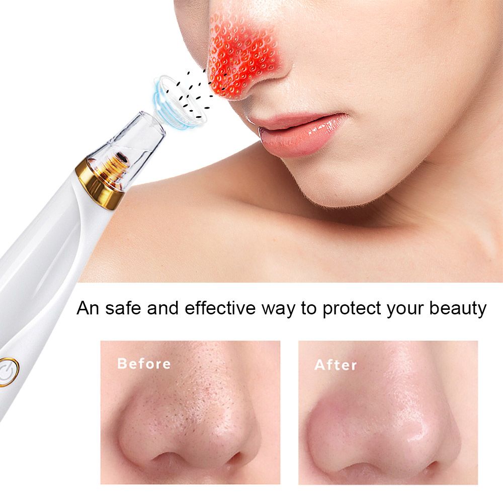 Blackhead Remover Pore Vacuum Pimple Extractor With Curved
