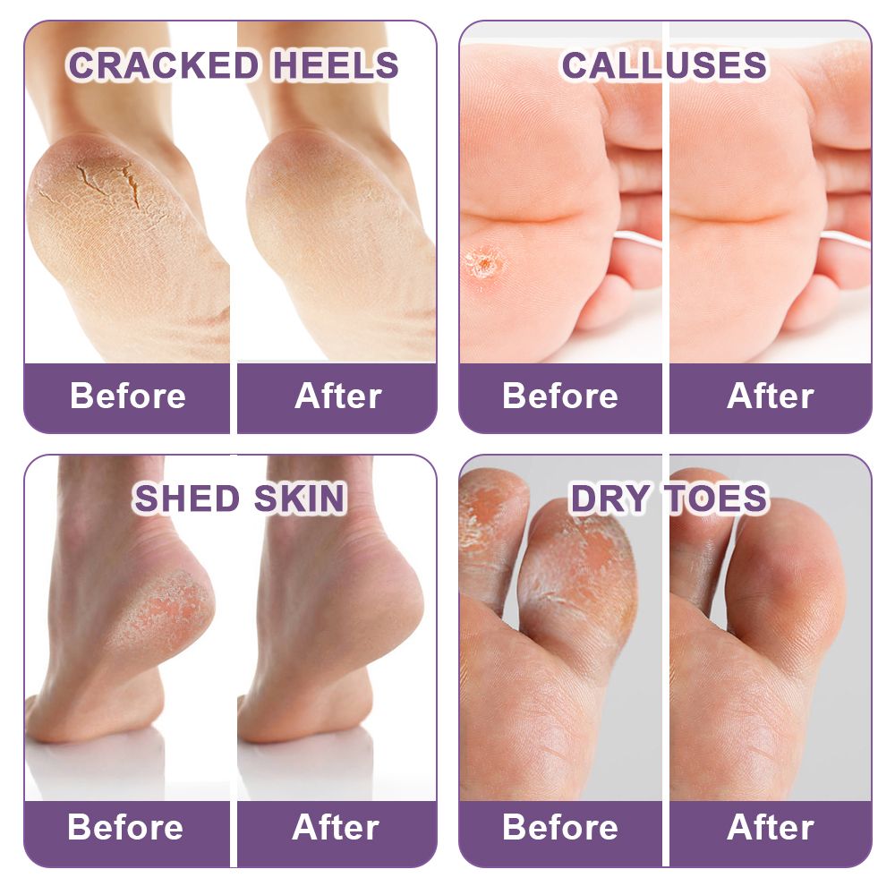 Feet Mask A Pair Of Lavender Scrub Exfoliating Skin Calluses