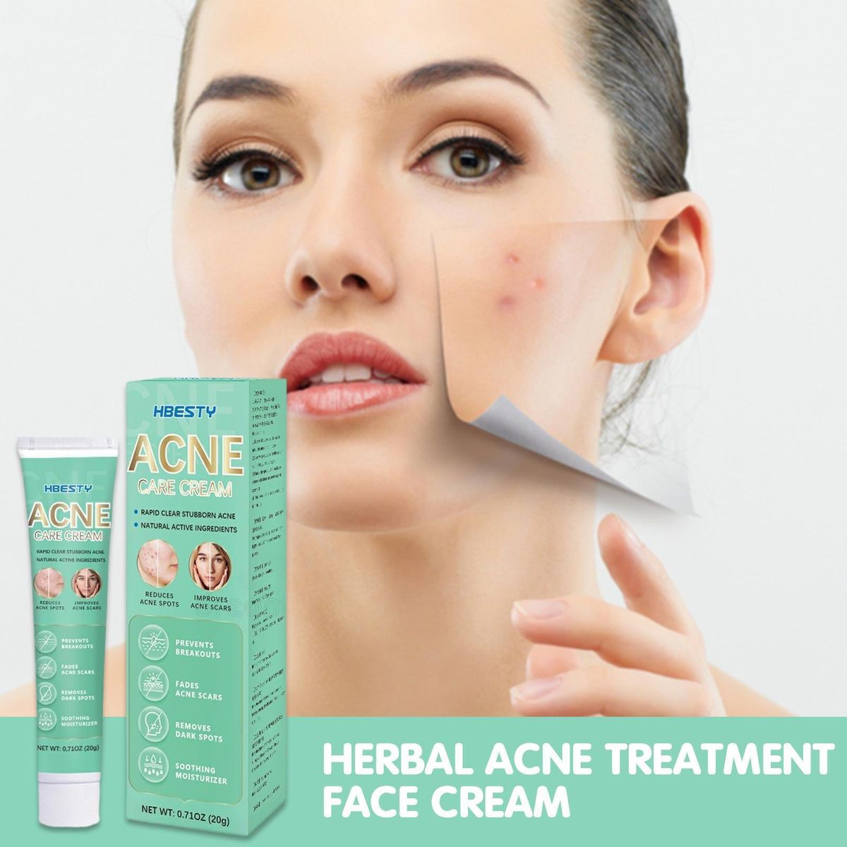ACNE REMOVER CREAM