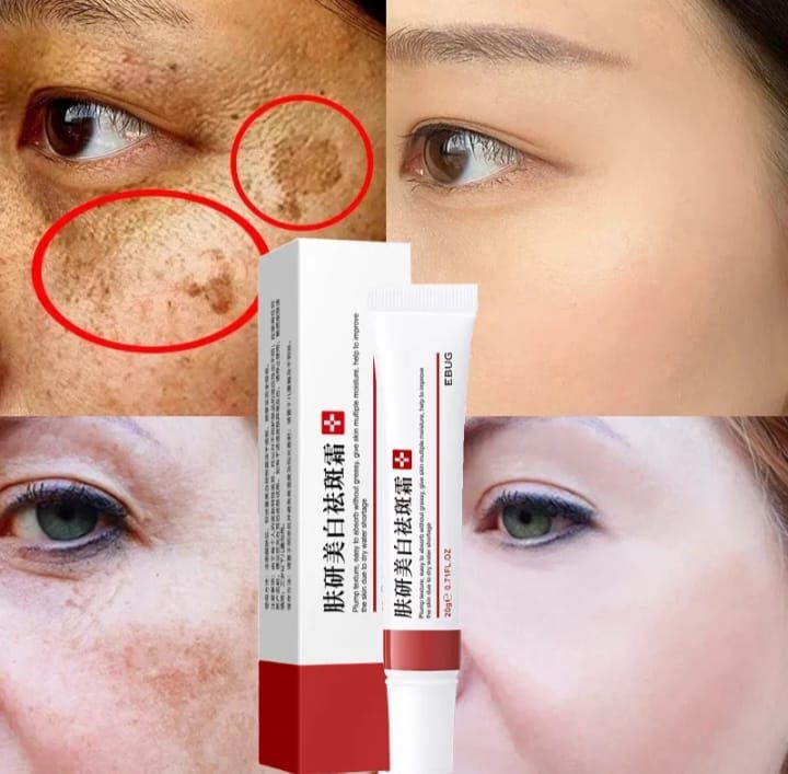2 In1 Sunburn Dark Spot,eye Bag & Anti Wrinkle Removal Cream