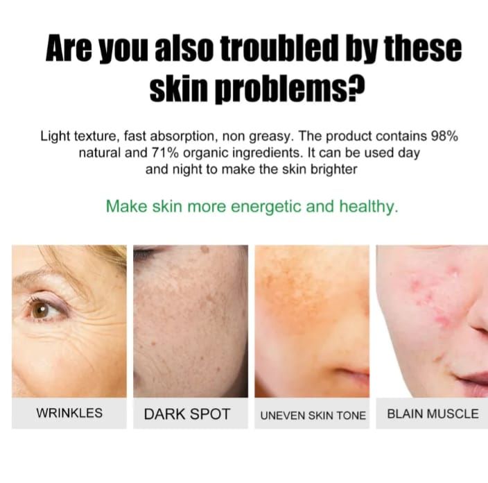 2 In1 Sunburn Dark Spot,eye Bag & Anti Wrinkle Removal Cream