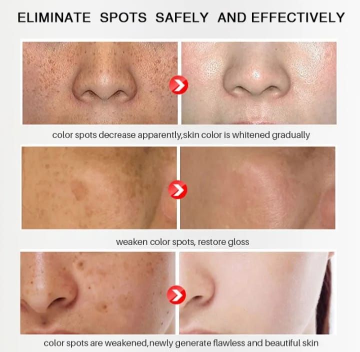 2 In1 Sunburn Dark Spot,eye Bag & Anti Wrinkle Removal Cream