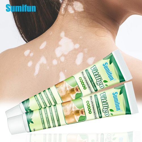 Vitiligo Removal Onitiment Treatments