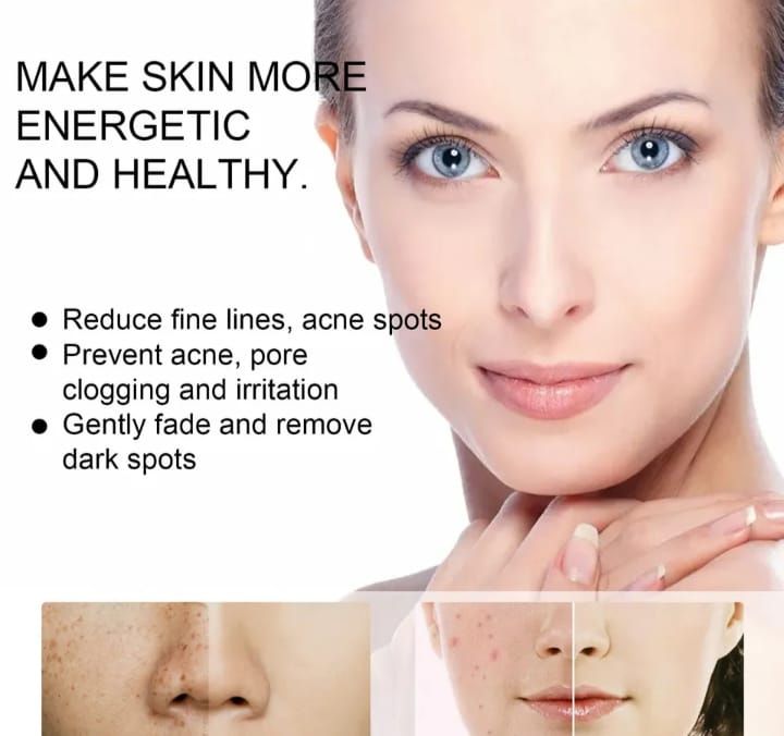 2 In 1 Sunburn, Dark Spots,eye Bag & Freckles Removal Cream