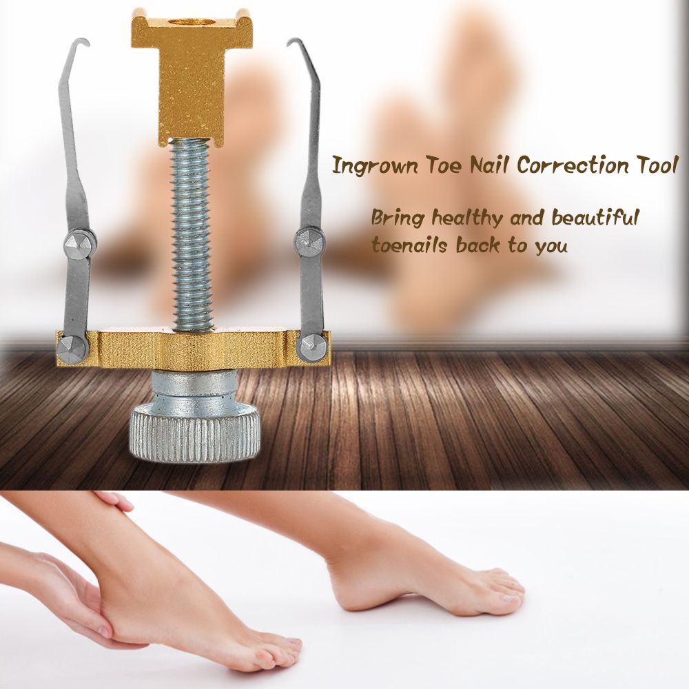 Professional Ingrown Toe Nail Correction Tool Toenail