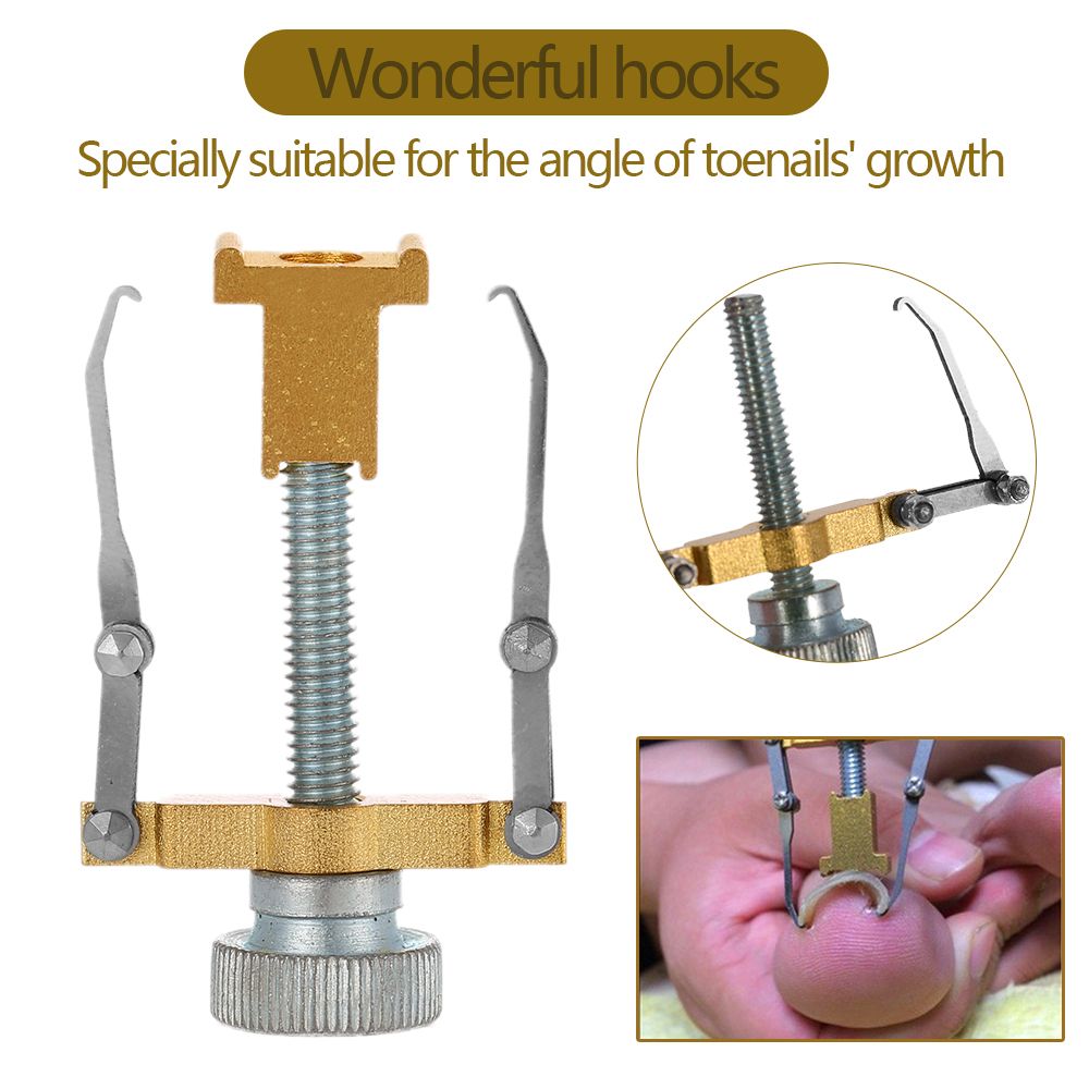 Professional Ingrown Toe Nail Correction Tool Toenail