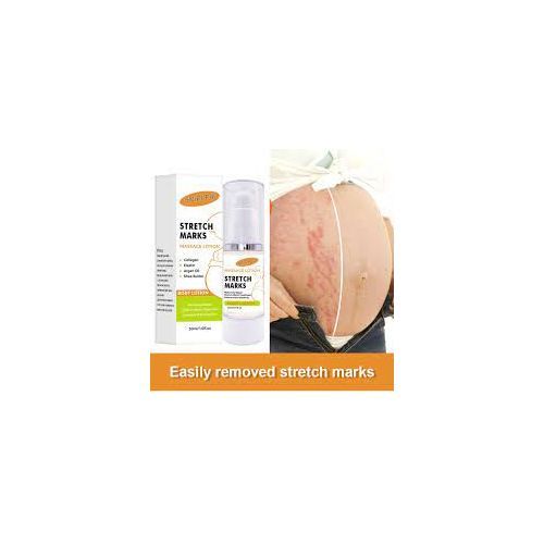 Pregnancy Tummy Scar / Stretch Mark Removal Cream
