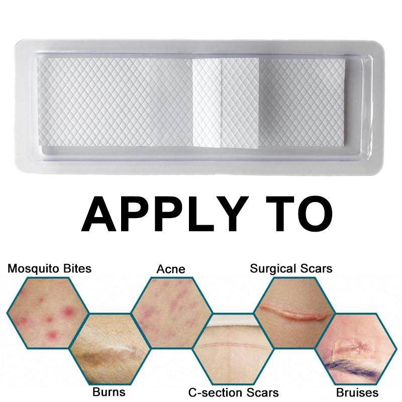 Adhesive Plaster To Scar White Film -section Scar Sticker From Sticky Silicone Adhesive Tape Transparent Processing.