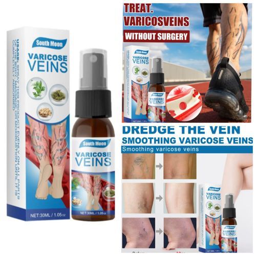 SOUTH MOON Premium Varicose Vein Removal Cream