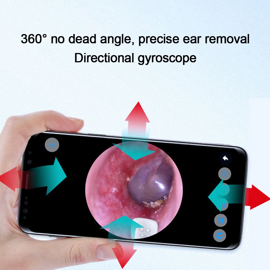 Otoscope Ear Buddies Ear Cleaner USB Ear Camera Digital Otoscope Camera 720P Video Ear Scope Ear Wax Removal Tool