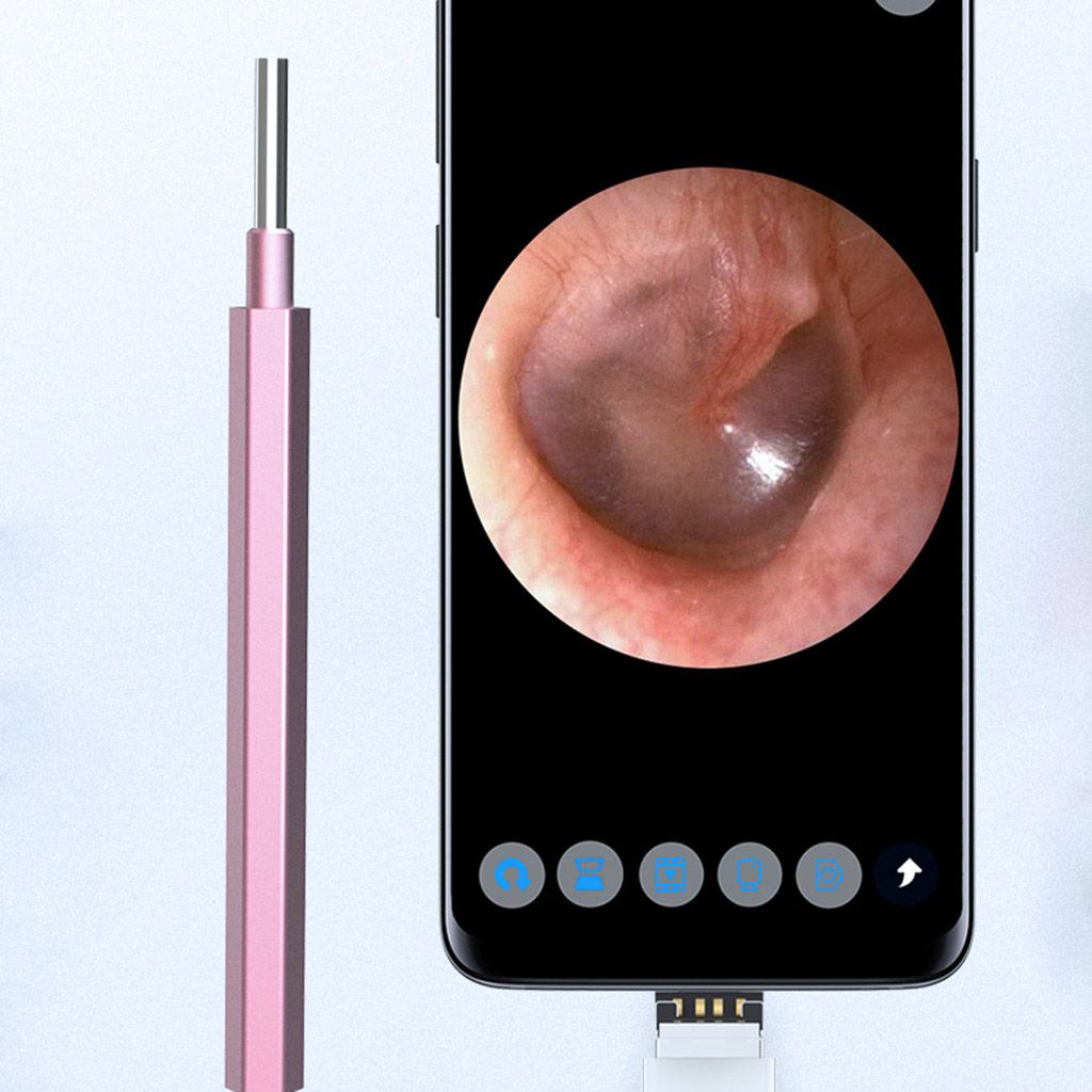 Otoscope Ear Buddies Ear Cleaner USB Ear Camera Digital Otoscope Camera 720P Video Ear Scope Ear Wax Removal Tool