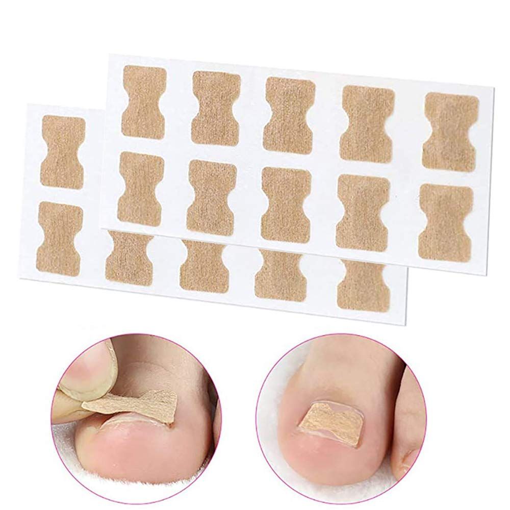Ingrown Toenail Sticker Glue Free Toenail Patch Tools Kit