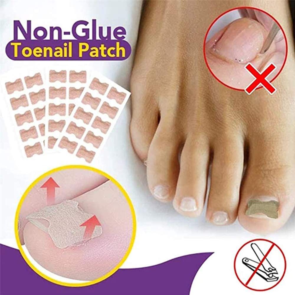 Ingrown Toenail Sticker Glue Free Toenail Patch Tools Kit