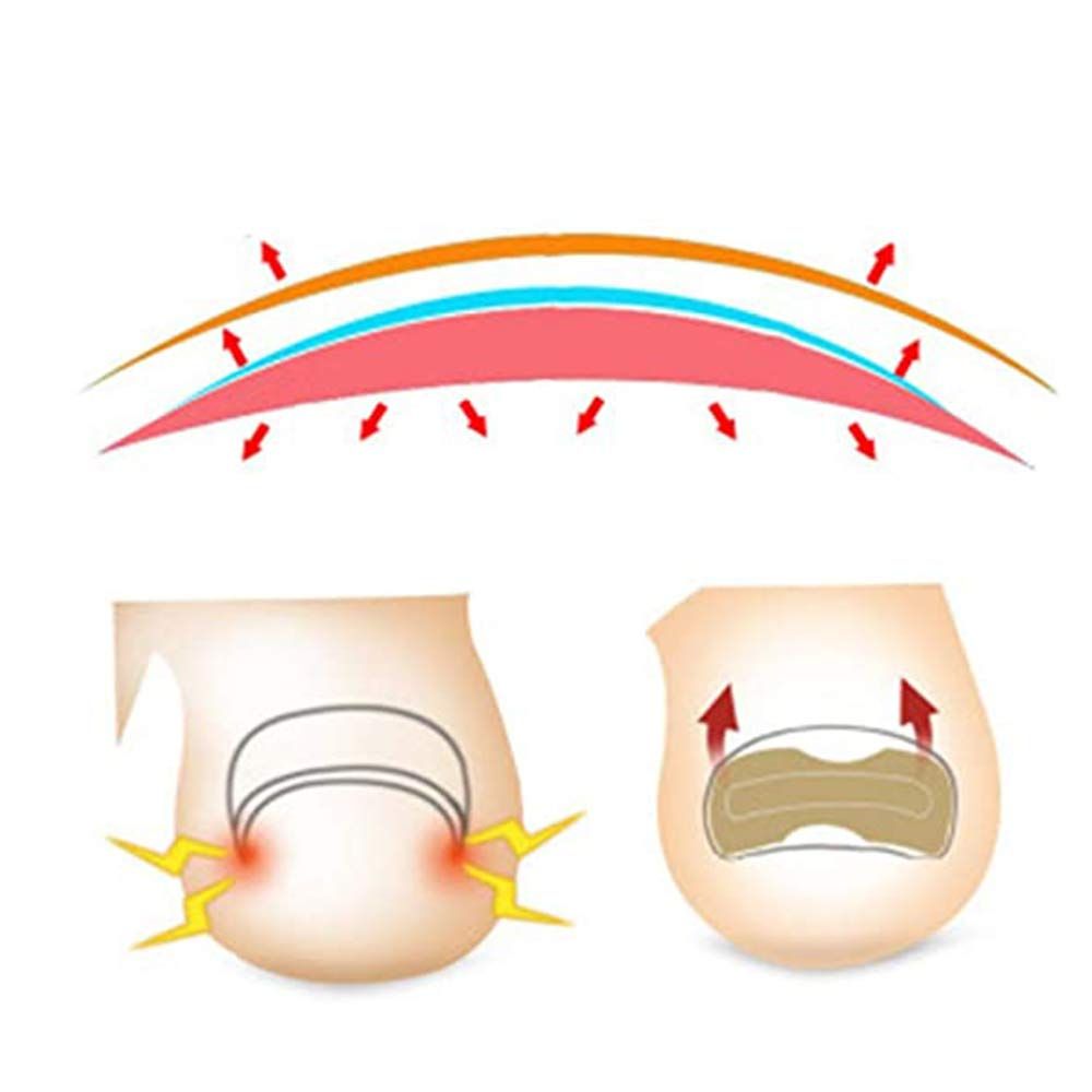 Ingrown Toenail Sticker Glue Free Toenail Patch Tools Kit