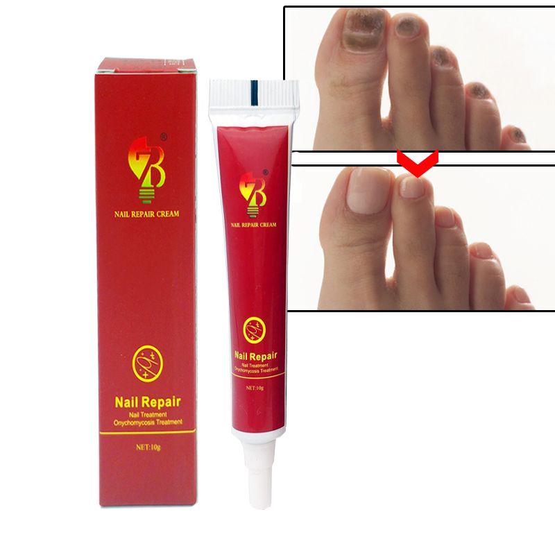 Repair Nail Care Skin Quality Nails Nail High Treatment Nail Tools Cream Fungus Cream Care Protector Herb