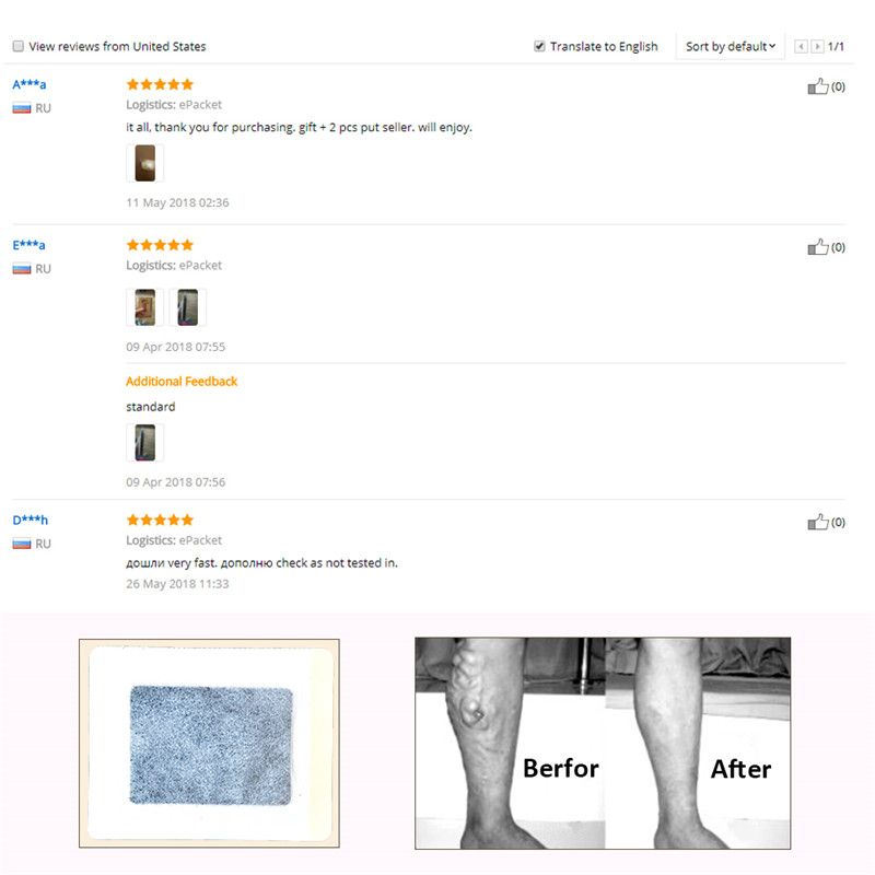 Veins Plaster Relief Pain Pcs Vasculitis Herbal Chinese Cream Varicosity Spider 10 Remedy Patch Angiitis Veins Medicine Varicose