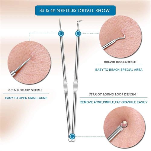 4pcs Stainless Steel Facial Acne Blackhead Remover Needles Kit Extractor Tool Set