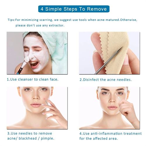 4pcs Stainless Steel Facial Acne Blackhead Remover Needles Kit Extractor Tool Set