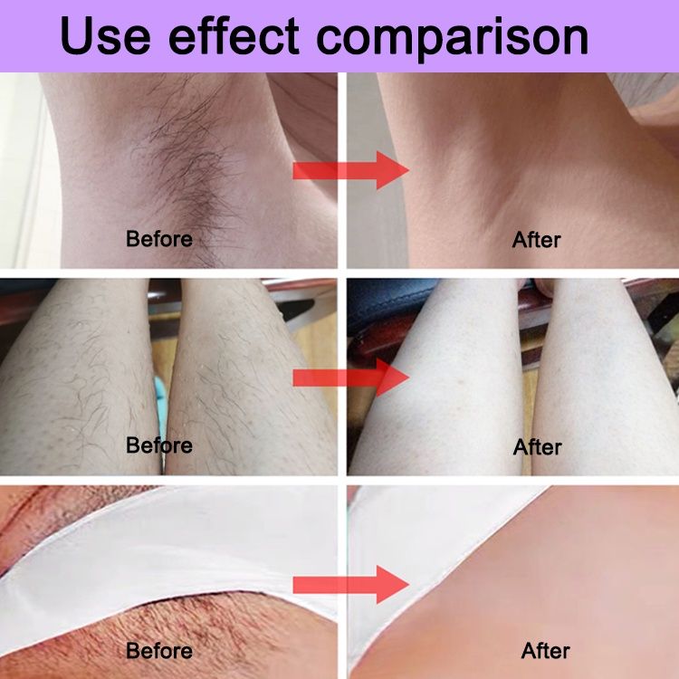 Chargable Electric Hair Shavers Body Leg Pubic For Women