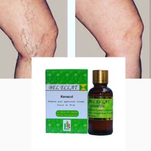 Eclat Kenacol Green Vein & Varicose Vein Eraser