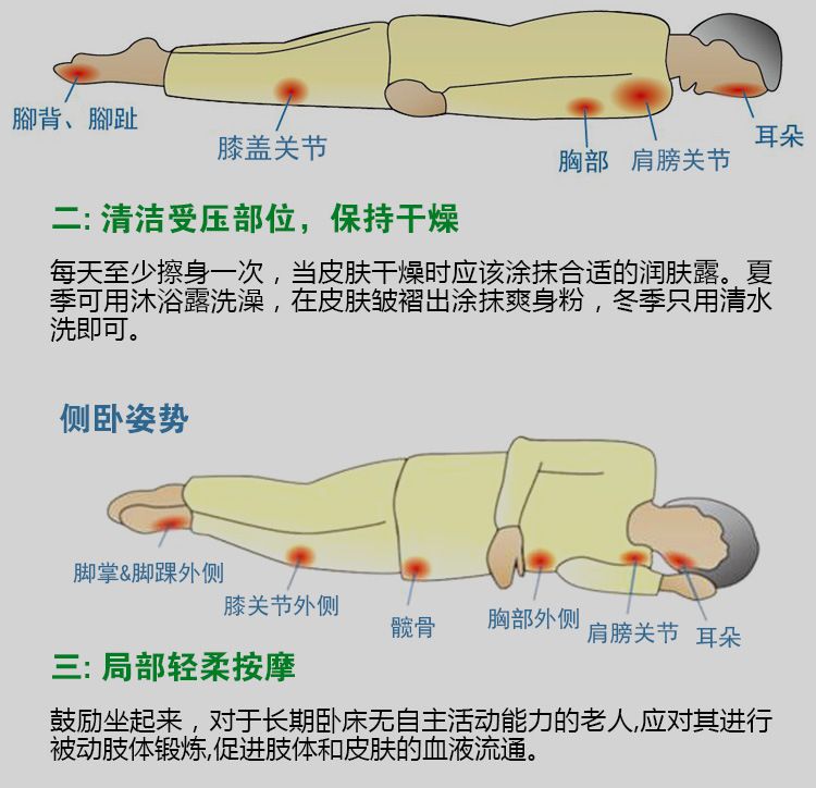 Removal Sores/Decubituses/Pressure Rot Pressure Bedsores Myogenic Cream Festering Ulcer Herbal Healing Wound 1PC Treat Paste