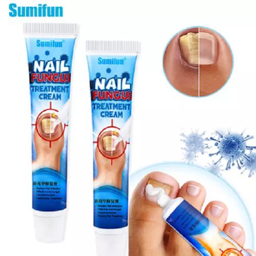 Nail Fungus Treatment Cream
