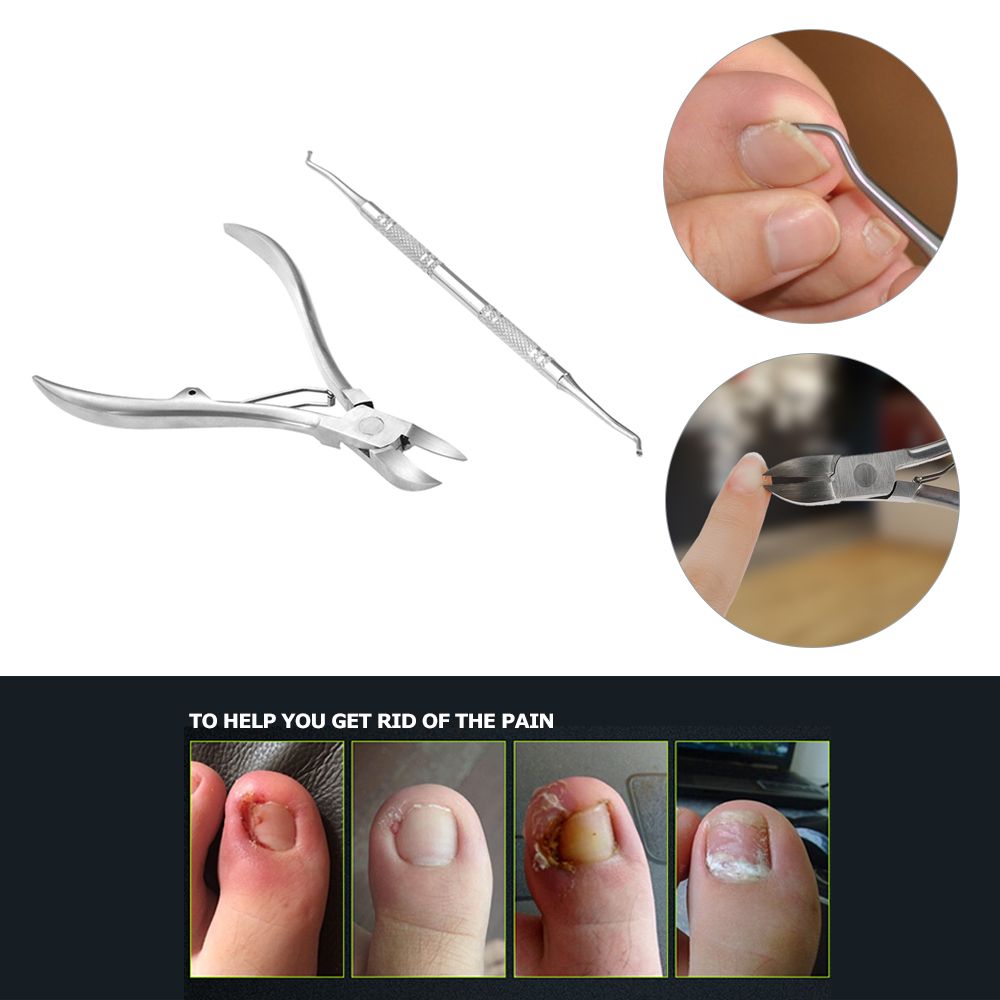 2pcs Stainless Steel Nail Cuticle Scissor + Ingrowing