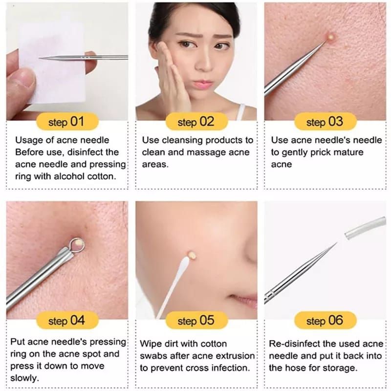 4pcs Stainless Steel Facial Acne Blackhead Remover Needles Kit Extractor Tool