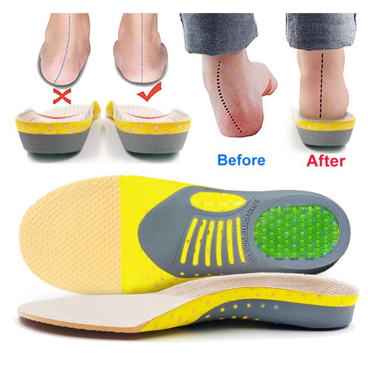 Orthopedic Flat Foot Sole Pad Orthotic Insoles Shoes Insert Sweat