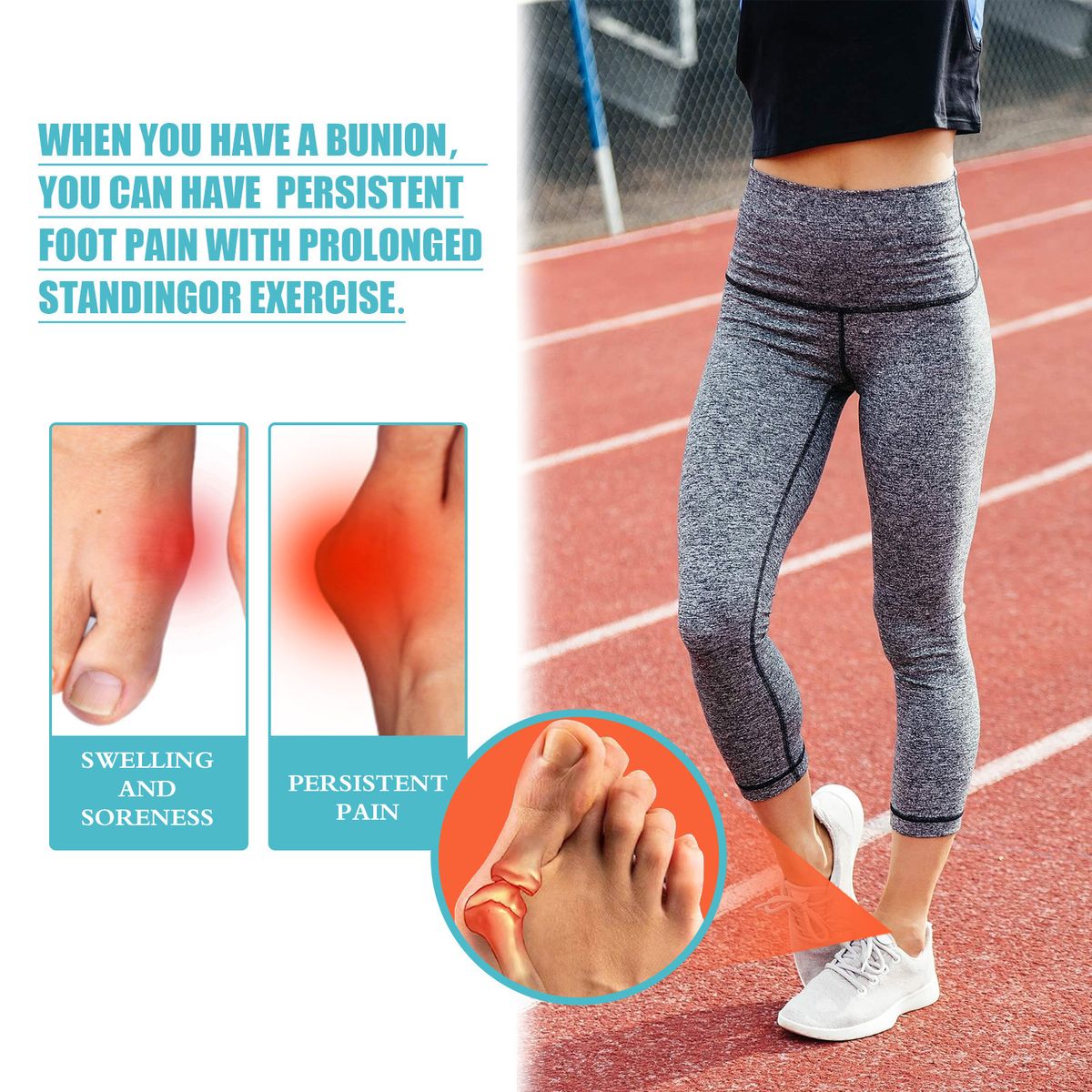 8PCS Bunion Patch Relief Bunion Swelling Pain