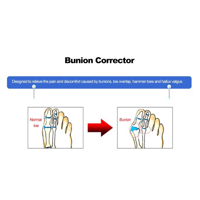 9Pcs/Set Bunion Corrector Big Toe Separators Straightener