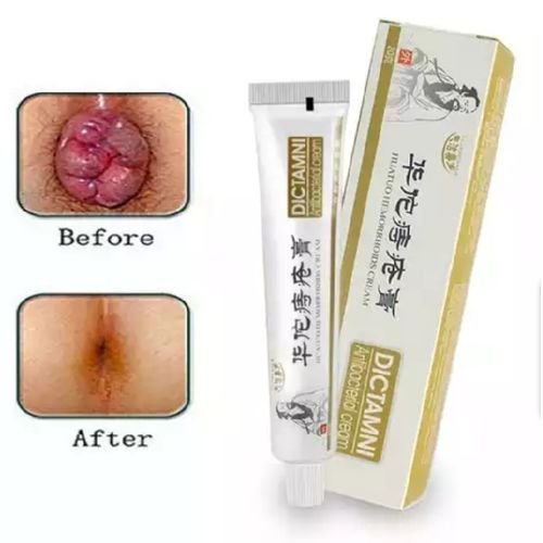 Powerful Chinese  Haemorrhoid  Treatments Cream X5