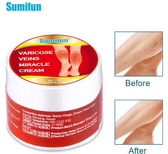 Varicose Veins Miracle Cream / Reduces Inflammation