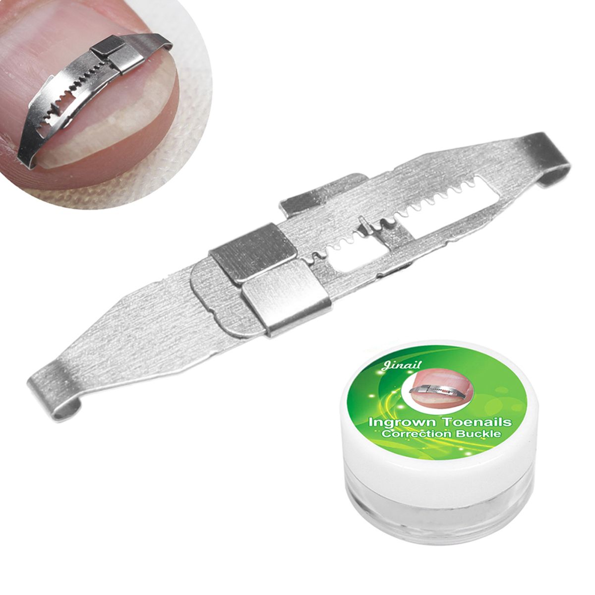 5pcs Ingrown Toenail Corrector Toenail Correction Treatment