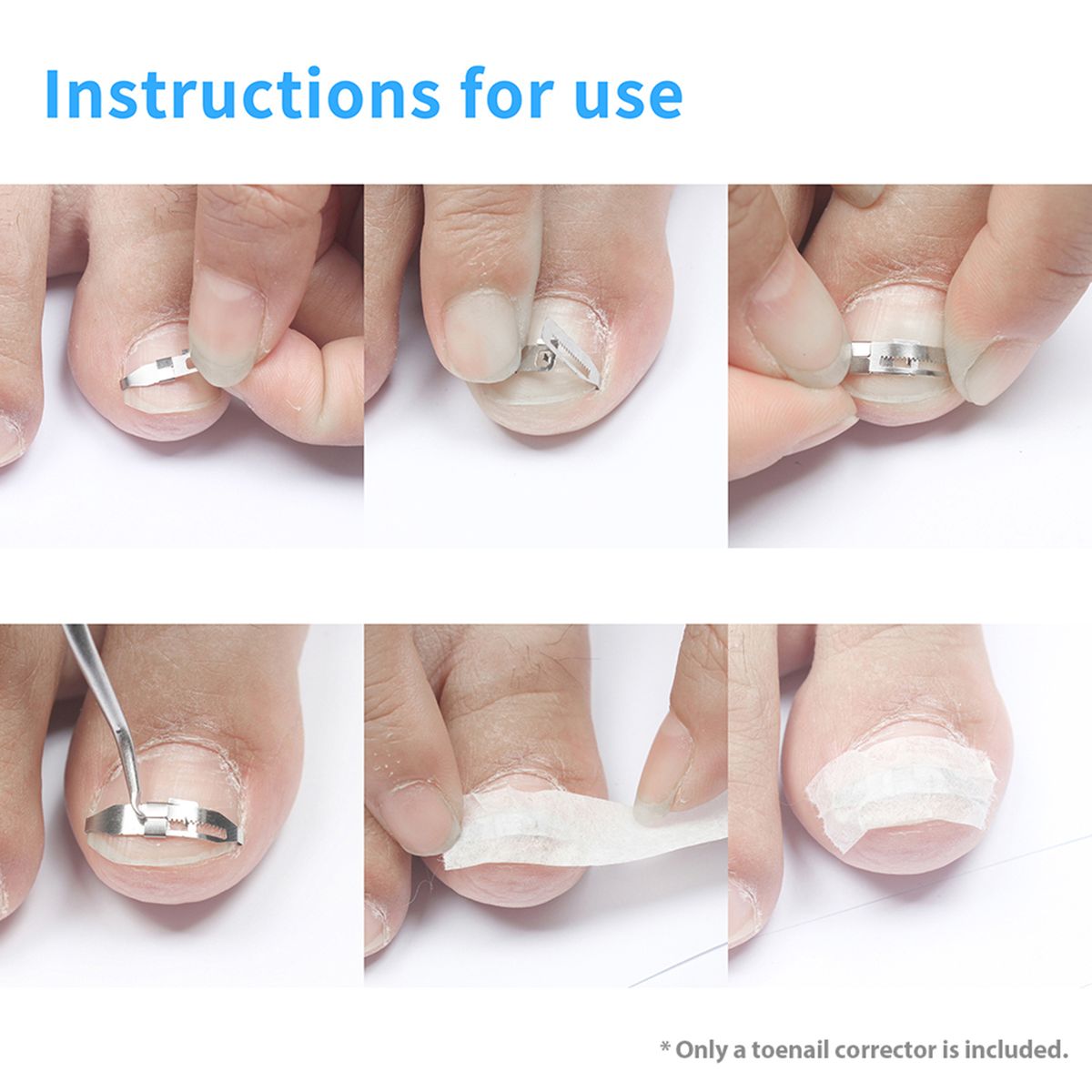 5pcs Ingrown Toenail Corrector Toenail Correction Treatment