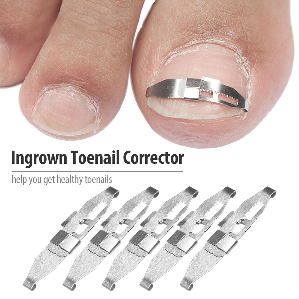 5pcs Ingrown Toenail Corrector Toenail Correction Treatment