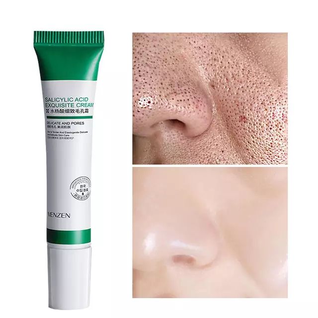 Salicylic Acid Acne Treatment & Scar Removal Cream