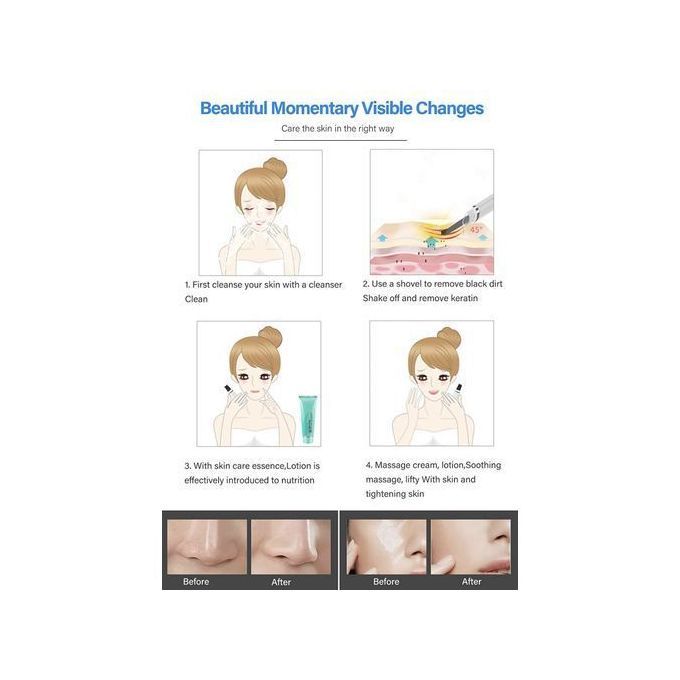 Facial Rejuvenation Deep Cleansing Skin Spatula