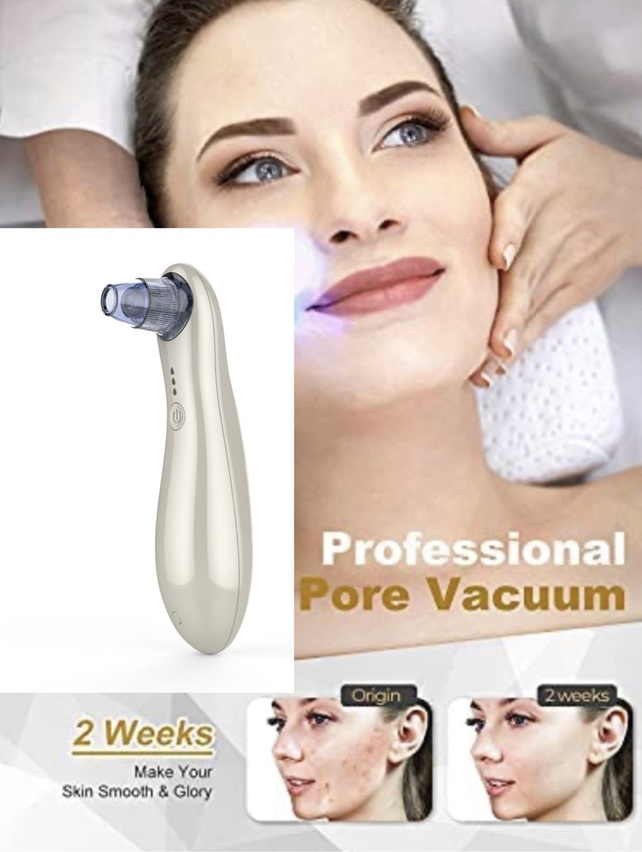 Blackhead Acne Removal,Deep Pore Cleansing Vacuum Suction