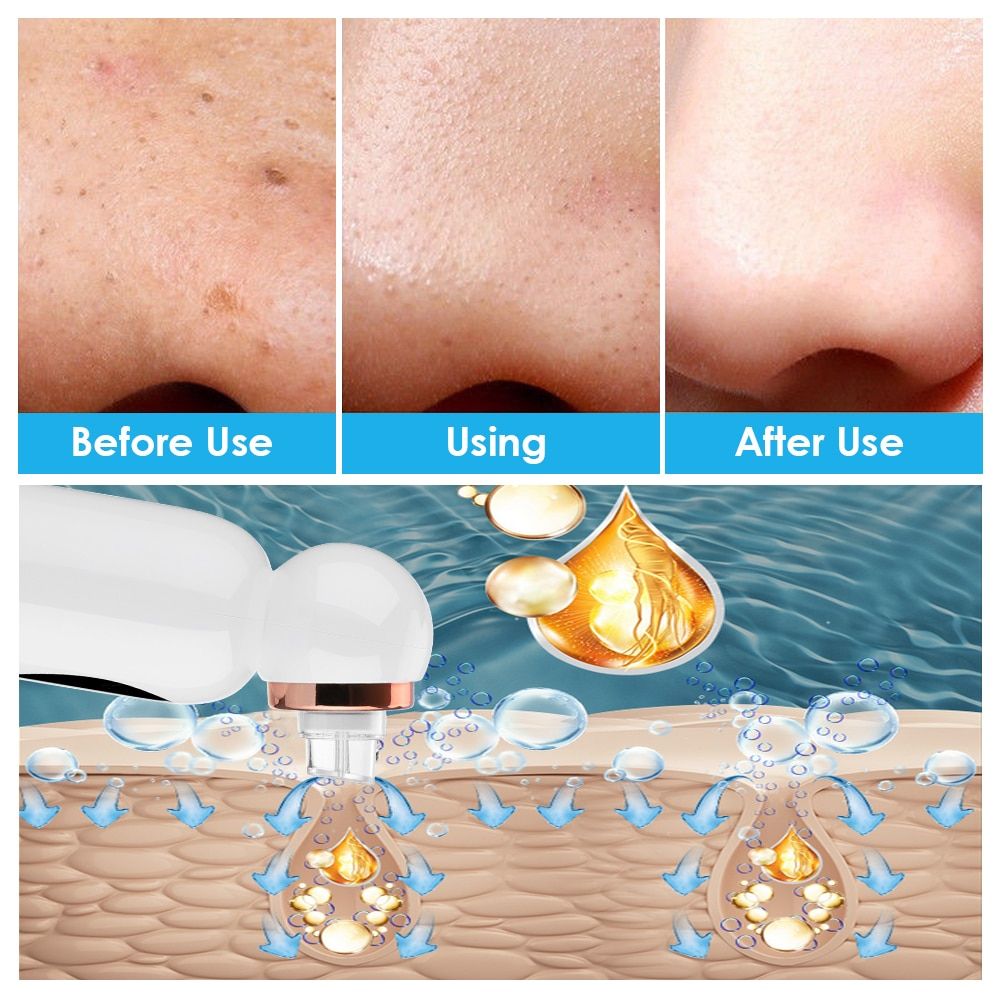 Blackhead Remover Vacuum Suction Small Bubble Pore Cleaner Device0 Pimple Extractor Microdermabrasion Electric Face Nose Cleaser